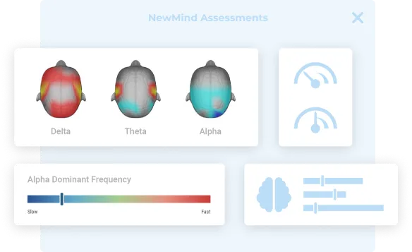 Image of a brain map report
